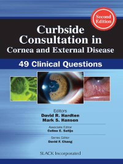 Curbside Consultation in Cornea and External Disease