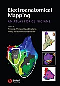 Electroanatomical Mapping