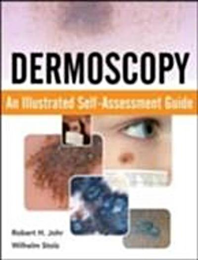 Dermoscopy: An Illustrated Self-Assessment Guide