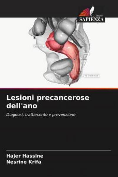 Lesioni precancerose dell’ano