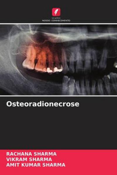 Osteoradionecrose