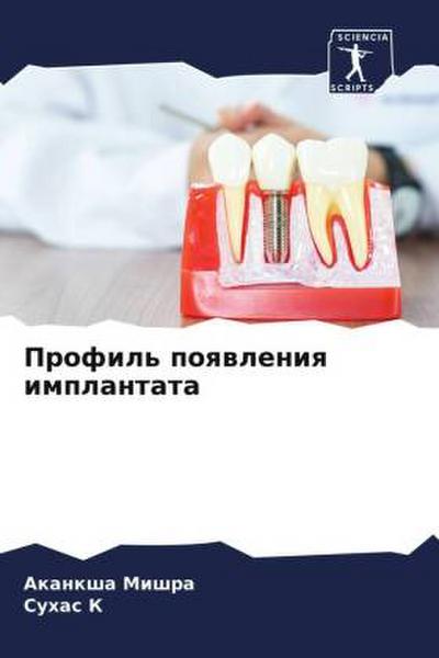 Profil’ poqwleniq implantata