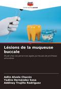 Lésions de la muqueuse buccale