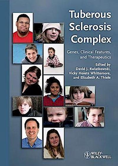 Tuberous Sclerosis Complex