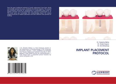 IMPLANT PLACEMENT PROTOCOL