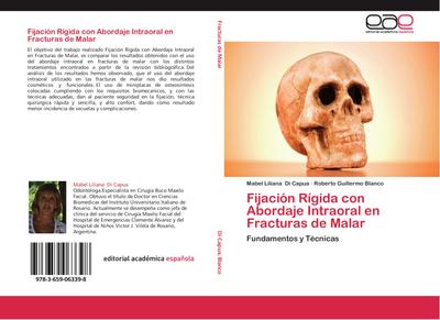 Fijación Rígida con Abordaje Intraoral en Fracturas de Malar