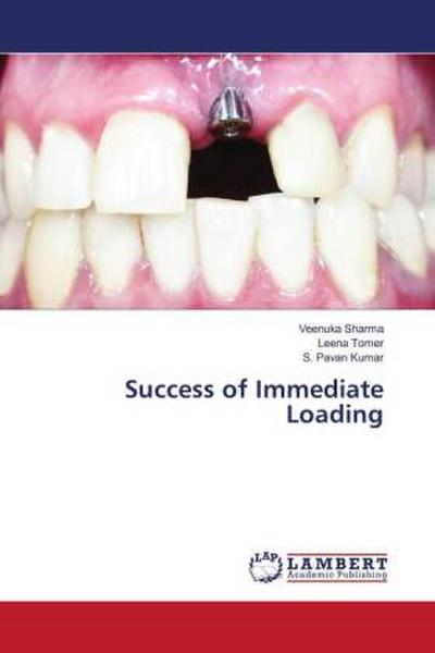 Success of Immediate Loading