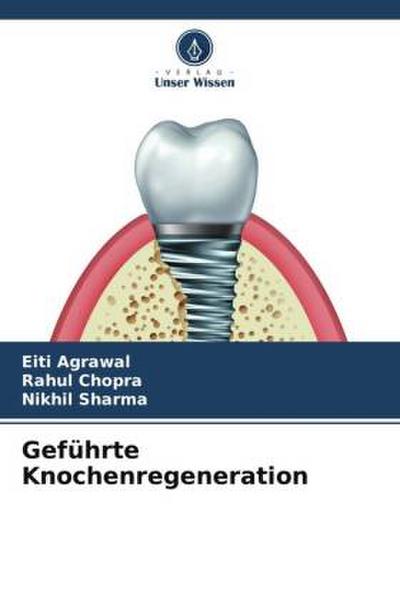 Geführte Knochenregeneration