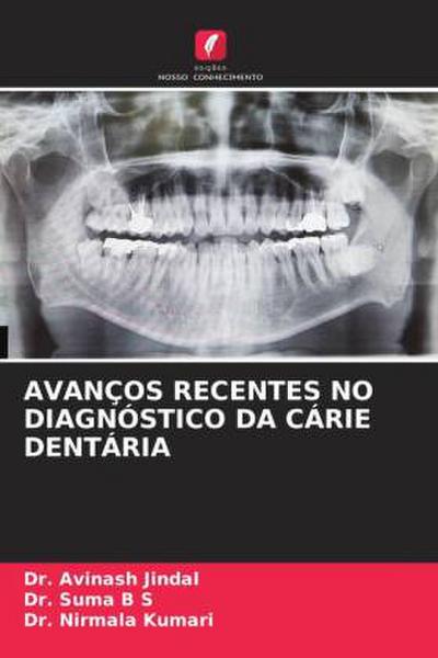 AVANÇOS RECENTES NO DIAGNÓSTICO DA CÁRIE DENTÁRIA