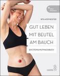 Gut leben mit Beutel am Bauch