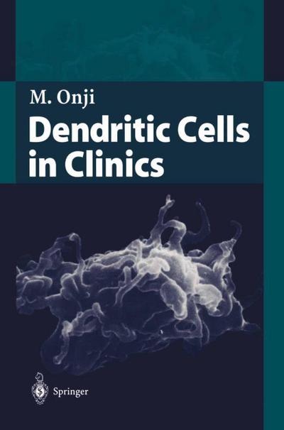 Dendritic Cells in Clinics