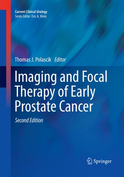 Imaging and Focal Therapy of Early Prostate Cancer