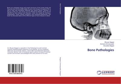 Bone Pathologies