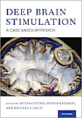 Deep Brain Stimulation