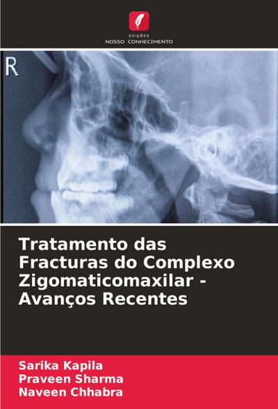 Tratamento das Fracturas do Complexo Zigomaticomaxilar - Avanços Recentes