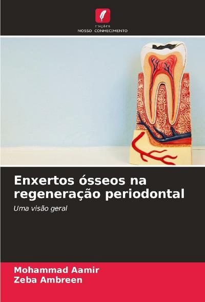 Enxertos ósseos na regeneração periodontal