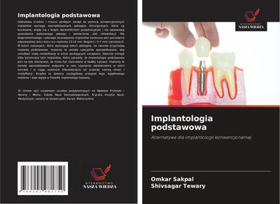 Implantologia podstawowa