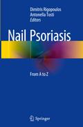 Nail Psoriasis