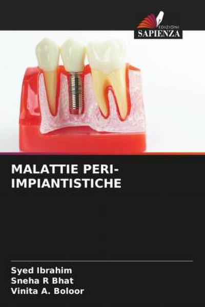 MALATTIE PERI-IMPIANTISTICHE