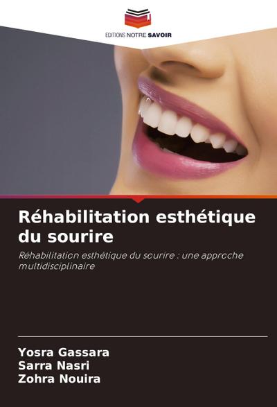Réhabilitation esthétique du sourire