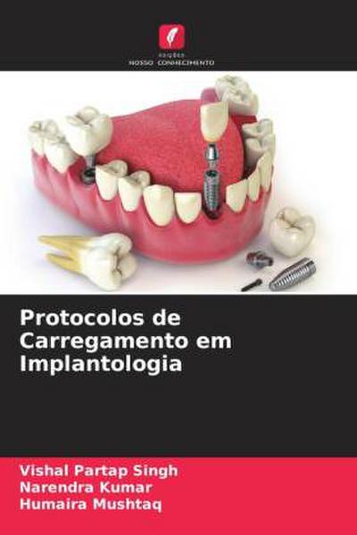 Protocolos de Carregamento em Implantologia
