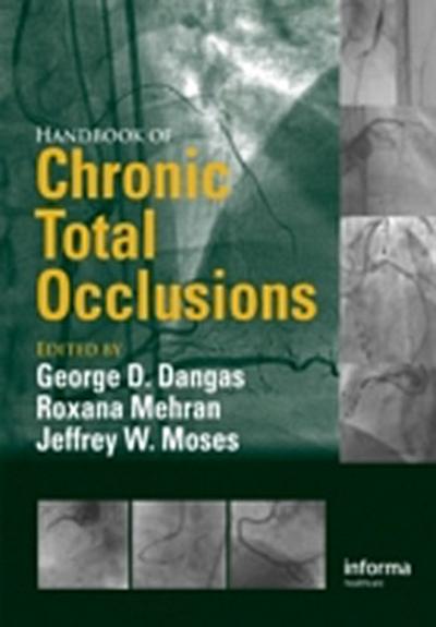 Handbook of Chronic Total Occlusions