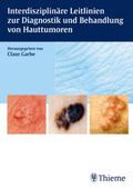 Interdisziplinäre Leitlinien zur Diagnostik und Behandlung von Hauttumoren