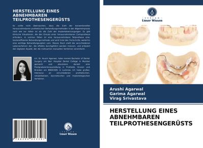 HERSTELLUNG EINES ABNEHMBAREN TEILPROTHESENGERÜSTS