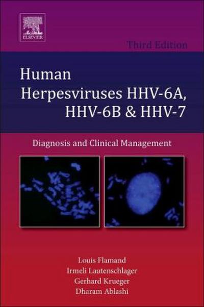 Human Herpesviruses Hhv-6a, Hhv-6b and Hhv-7