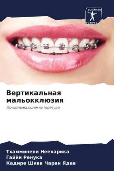 Vertikal’naq mal’okklüziq