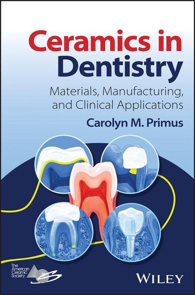 Ceramics in Dentistry