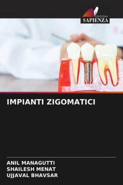 IMPIANTI ZIGOMATICI