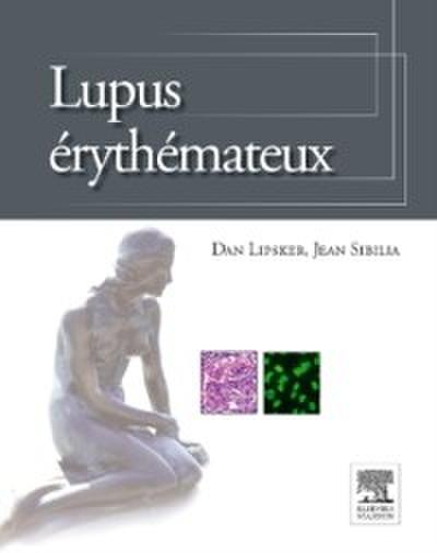 Lupus erythemateux