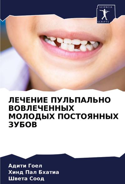 LEChENIE PUL’PAL’NO VOVLEChENNYH MOLODYH POSTOYaNNYH ZUBOV