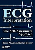 ECG Interpretation