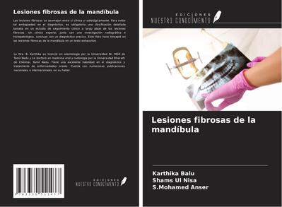 Lesiones fibrosas de la mandíbula