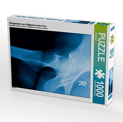 Röntgenbild vom Hüftgelenk einer Frau. (Puzzle)