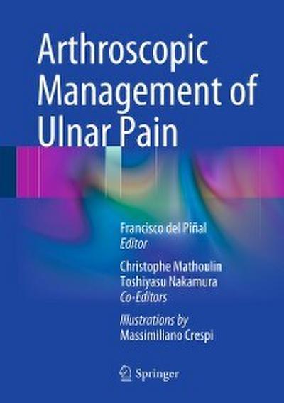 Arthroscopic Management of Ulnar Pain