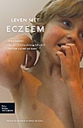 Leven met eczeem