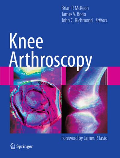 Knee Arthroscopy