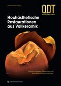 Hochästhetische Restaurationen aus Vollkeramik von Vincent Fehmer | Ebook