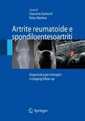 Artrite reumatoide e spondiloentesoartriti - Giacomo Garlaschi