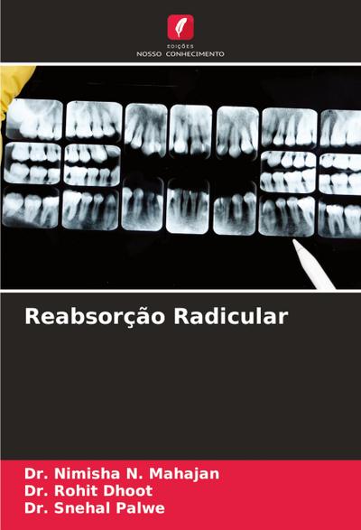 Reabsorção Radicular