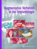 Augmentative Verfahren in der Implantologie von Fouad Khoury | Ebook