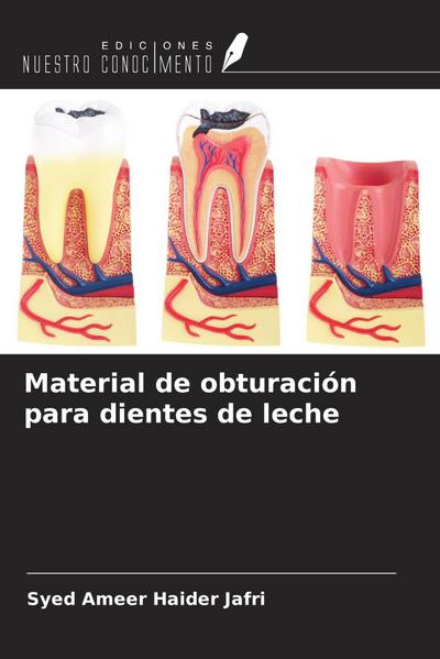 Material de obturación para dientes de leche