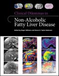 Clinical Dilemmas in Non-Alcoholic Fatty Liver Disease