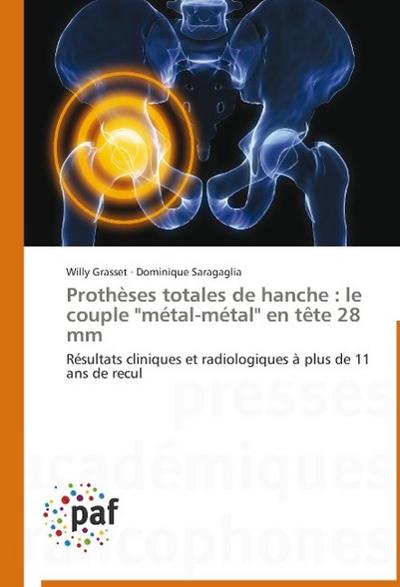 Prothèses totales de hanche : le couple "métal-métal" en tête 28 mm