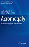 Acromegaly