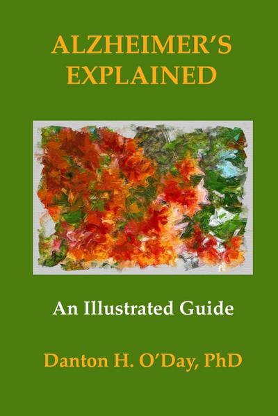 Alzheimer’s Explained, An Illustrated Guide