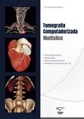 Tomografia Computadorizada Multislice
